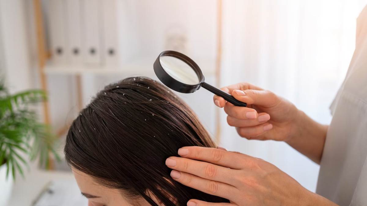 Dandruff Treatment: பொடுகு தொல்லையால் அவதியா? இதை ட்ரை பண்ணுங்க ஒரே வாரத்தில் நல்ல ரிசல்ட் கிடைக்கும்!