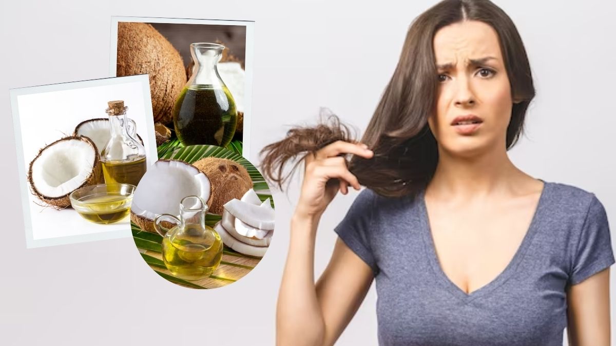 Coconut Oil Benefits: முடி உதிர்கிறதா? தேங்காய் எண்ணெய் யூஸ் பண்ணுங்க..