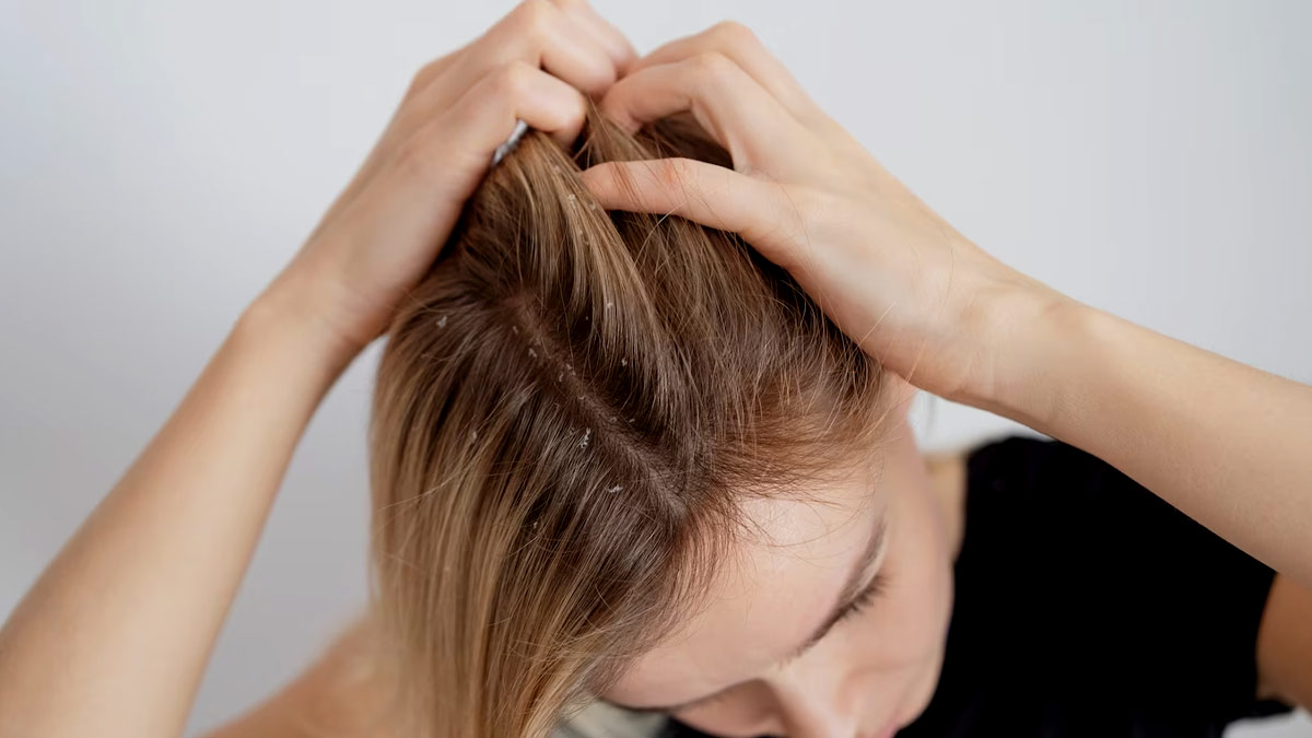 Dealing With Itchy Scalp? Follow These Easy Tips To Say Goodbye To It