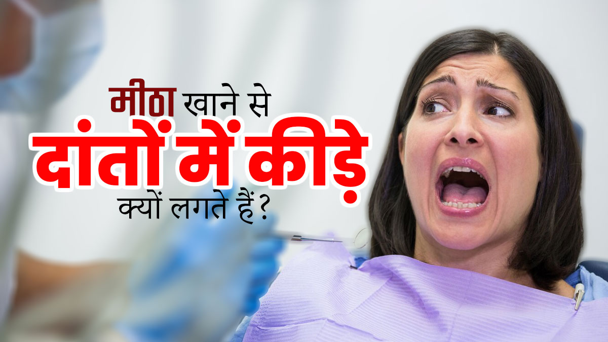 मीठा खाने से दांतों में कीड़े क्यों लगते हैं? जानें बचाव के टिप्स